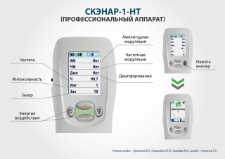 СКЭНАР-1-НТ (исполнение 01)  в Гулькевиче купить Скэнар официальный сайт - denasvertebra.ru 